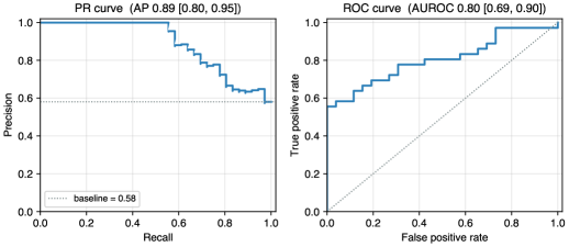 PCA reconstruction error distribution