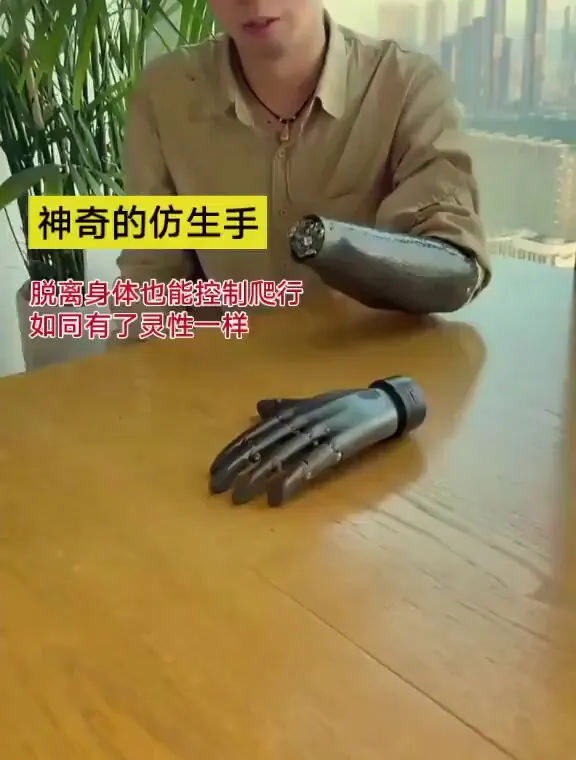 Wireless EMG bionic hand with independent finger movement