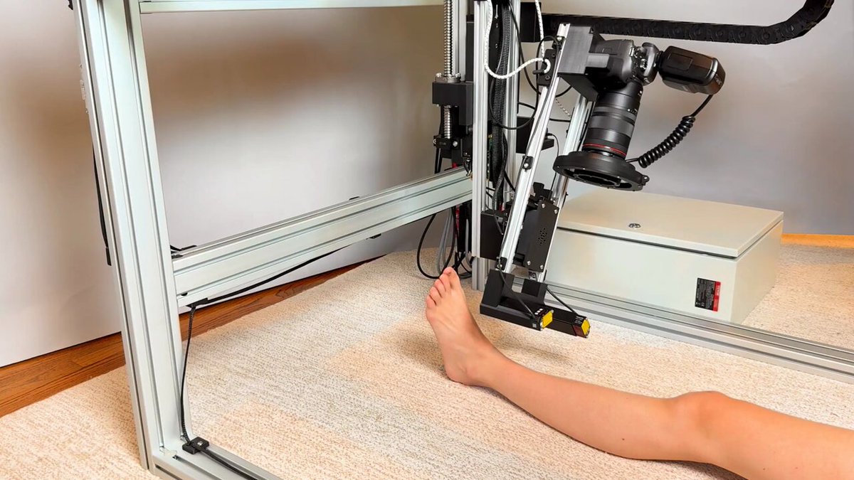 Open-Source 3D Skin Scanning Robot for Mole Tracking